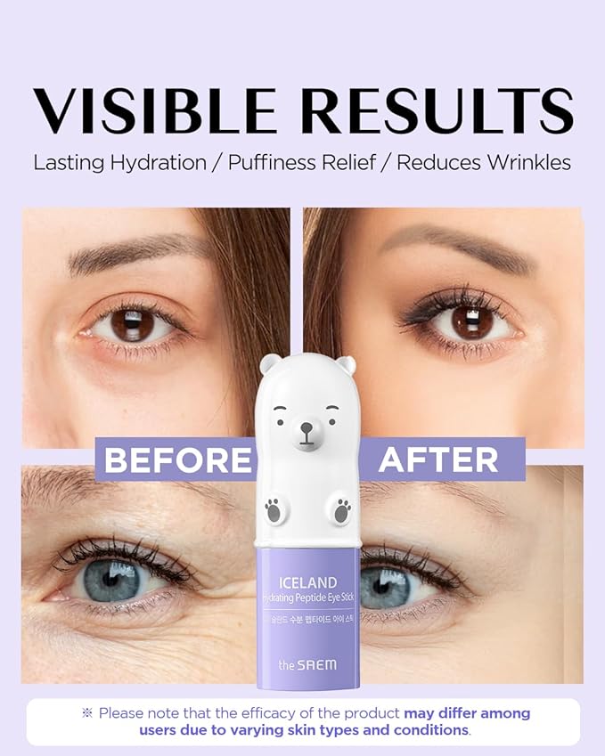 THESAEM Iceland Hydrating Peptide Eye Stick 0.24oz - Elasticity, Cooling, Moisturizing Eye Balm for Loose Skin – Under Eye Treatment - Balm to Smooth Skin Texture - Daisy Flower Scent