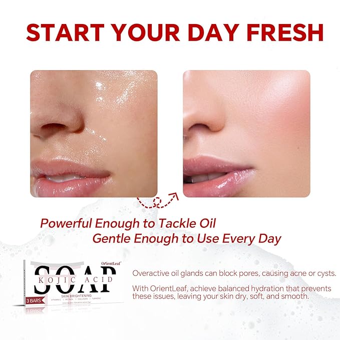 Kojic Acid Soap, Turmeric Soap Bar for Dark Spots, Fresh Citurs Scent, Gentle for Face and Body Wash with Vitamin C, Shea Butter, Retinol, Olive Oil, Collagen (3 PACK)