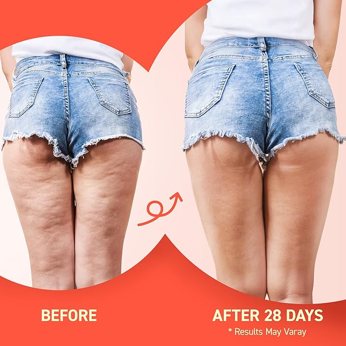 Enaskin Naturals Anti Cellulite Body Firming Cream: Tightening & Lifting Booty Lotion with 3D Thermal Tech for Thighs, Belly, Bum & Women Sagging Skin, Shea Butter & Coconut Oil, 3.4 oz